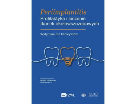 Periimplantitis Profilaktyka i leczenie tkanek okołowszczepowych