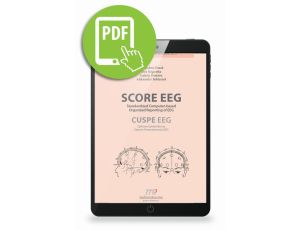 SCORE EEG Standardized Computer-based Organized Reporting of EEG. CUSPE EEG Cyfrowy Ujednolicony System Prezentowania EEG