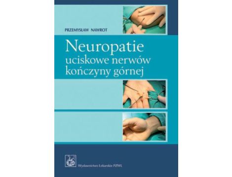 Neuropatie uciskowe nerwów kończyny górnej