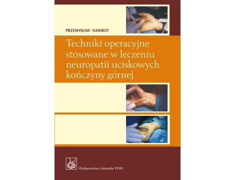 Techniki operacyjne stosowane w leczeniu neuropatii uciskowych kończyny górnej.