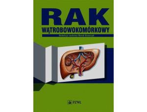 Rak wątrobowokomórkowy