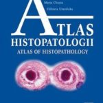 Tytuł: Atlas histopatologii.Tajemniczy świat chorych komórek człowieka
Autor: Wenancjusz Domagała, Maria Chosia, Elżbieta Urasińska
Wydawnictwo: PZWL
Formaty: MOBI, EPUB