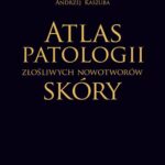 Tytuł: Atlas patologii złośliwych nowotworów skóry
Autor: Leszek Woźniak, Krzysztof W. Zieliński, Andrzej Kaszuba
Wydawnictwo: PZWL
Formaty: EPUB, MOBI