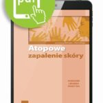 Tytuł: Atopowe zapalenie skóry
Autor: 
Wydawnictwo: Medical Education
Formaty: PDF