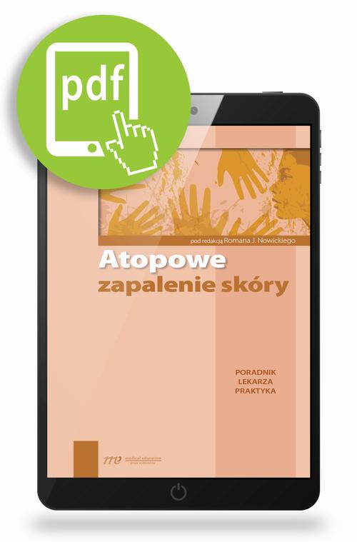 Tytuł: Atopowe zapalenie skóry
Autor: 
Wydawnictwo: Medical Education
Formaty: PDF