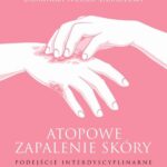 Tytuł: Atopowe zapalenie skóry Podejście interdyscyplinarne
Autor: 
Wydawnictwo: PZWL
Formaty: EPUB, MOBI
