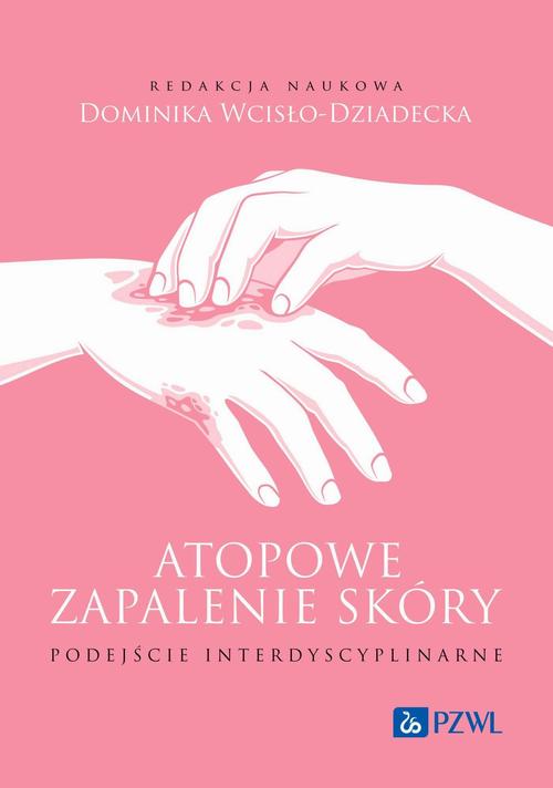Tytuł: Atopowe zapalenie skóry Podejście interdyscyplinarne
Autor: 
Wydawnictwo: PZWL
Formaty: EPUB, MOBI