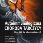 Tytuł: Autoimmunologiczna choroba tarczycy
Autor: 
Wydawnictwo: PZWL
Formaty: MOBI, EPUB
