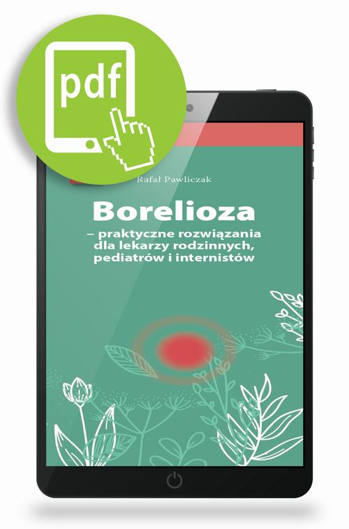 Tytuł: Borelioza - praktyczne rozwiązania, dla lekarzy rodzinnych, pediatrów i internistów
Autor: Rafał Pawliczak
Wydawnictwo: Medical Education
Formaty: PDF