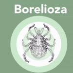Tytuł: Borelioza
Autor: Anna Grzeszczuk, Joanna Zajkowska
Wydawnictwo: PZWL
Formaty: MOBI, EPUB