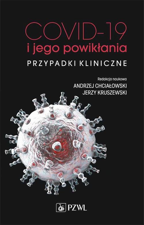 Tytuł: COVID-19 i jego powikłania - przypadki kliniczne
Autor: 
Wydawnictwo: PZWL
Formaty: EPUB, MOBI