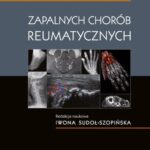 Diagnostyka obrazowa zapalnych chorób reumatycznych — okładka e-booka