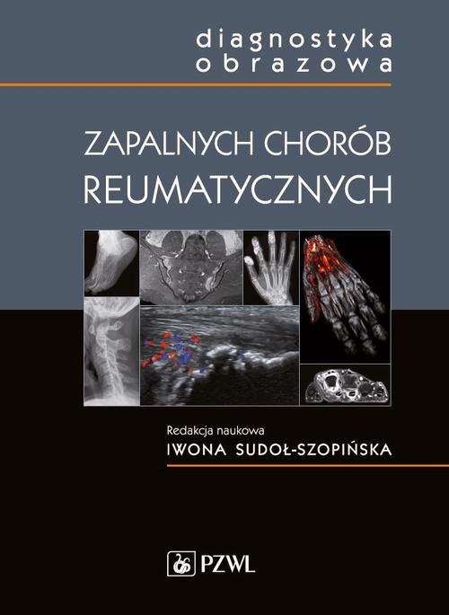 Diagnostyka obrazowa zapalnych chorób reumatycznych — okładka e-booka