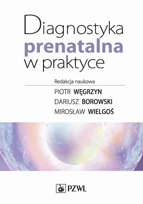 Diagnostyka prenatalna w praktyce — okładka e-booka