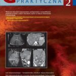 Tytuł: Gastroenterologia Praktyczna 2/2017
Autor: 
Wydawnictwo: Czelej
Formaty: MOBI, EPUB