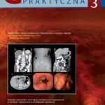 Tytuł: Gastroenterologia Praktyczna 3/2017
Autor: 
Wydawnictwo: Czelej
Formaty: MOBI, EPUB