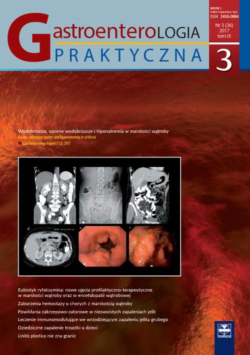 Tytuł: Gastroenterologia Praktyczna 3/2017
Autor: 
Wydawnictwo: Czelej
Formaty: MOBI, EPUB