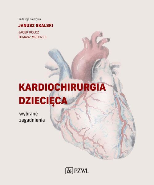 Kardiochirurgia dziecięca — okładka e-booka