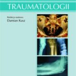 Kompendium traumatologii — okładka e-booka
