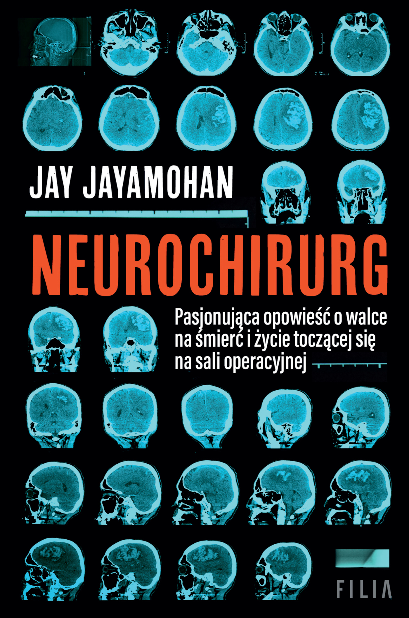 Tytuł: Neurochirurg
Autor: Jay Jayamohan
Wydawnictwo: FILIA
Formaty: EPUB, MOBI