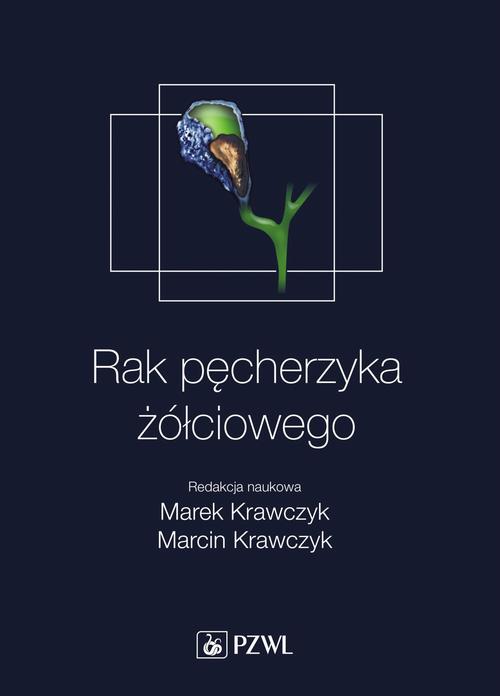 Rak pęcherzyka żółciowego — okładka e-booka