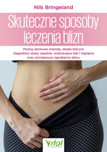 Skuteczne sposoby leczenia blizn. Poznaj domowe metody, dzięki którym złagodzisz stany zapalne, zredukujesz ból i napięcia oraz zmniejszysz zgrubienia skóry " — okładka e-booka