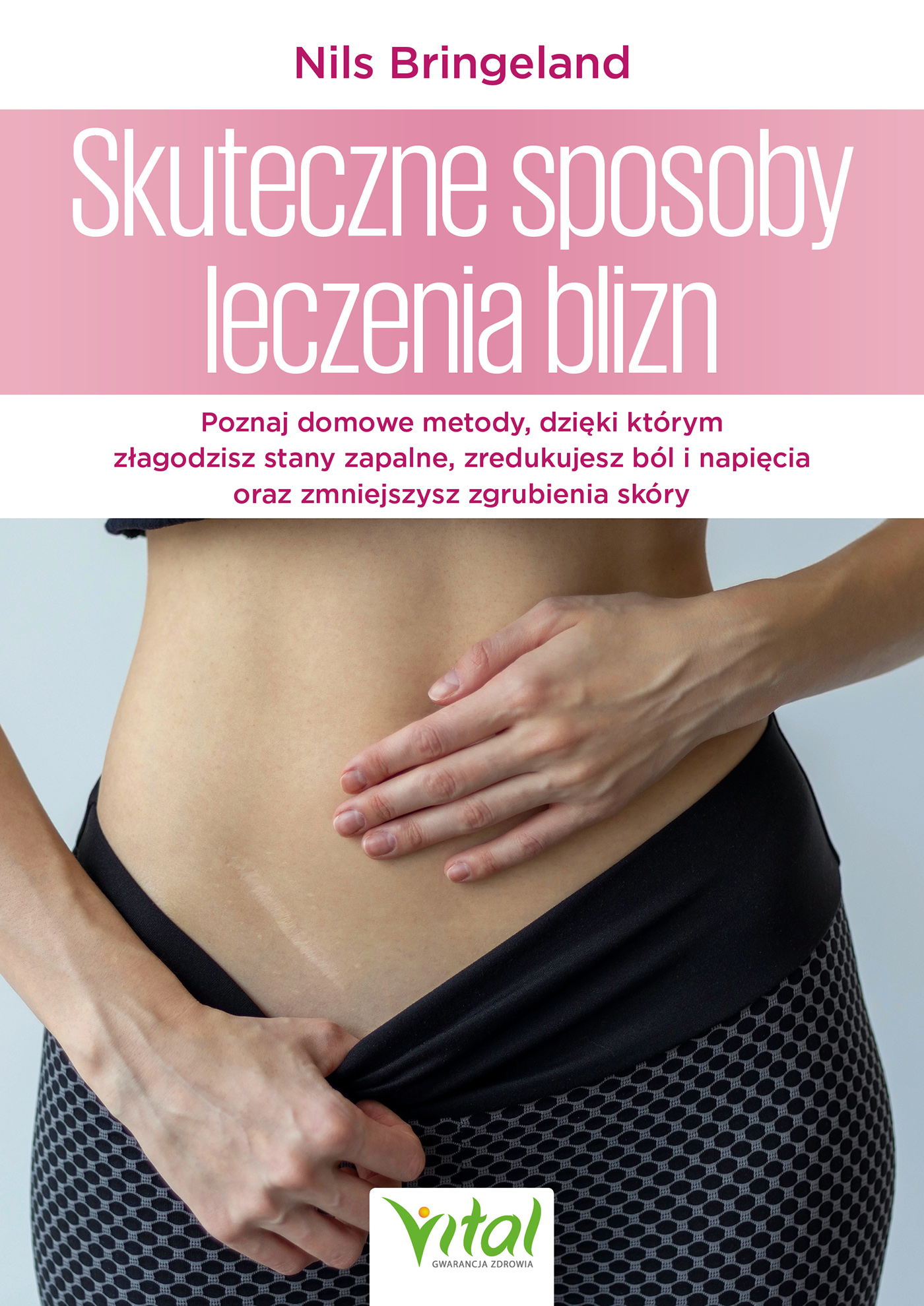 Skuteczne sposoby leczenia blizn. Poznaj domowe metody, dzięki którym złagodzisz stany zapalne, zredukujesz ból i napięcia oraz zmniejszysz zgrubienia skóry " — okładka e-booka