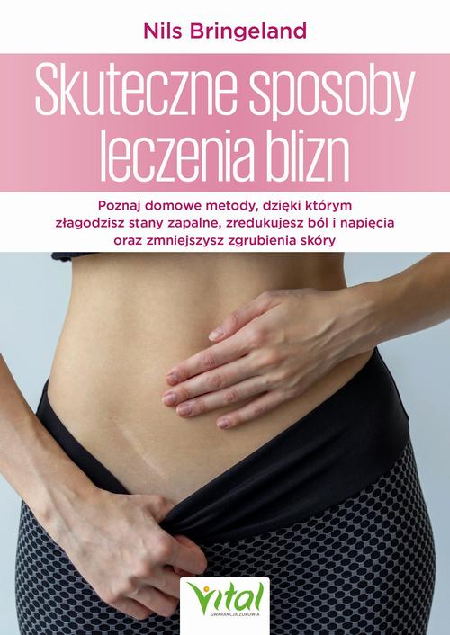 Skuteczne sposoby leczenia blizn — okładka e-booka