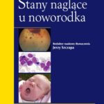 Stany naglące u noworodka — okładka e-booka