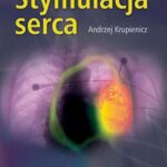 Stymulacja serca — okładka e-booka