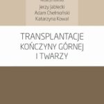 Transplantacje kończyny górnej i twarzy — okładka e-booka