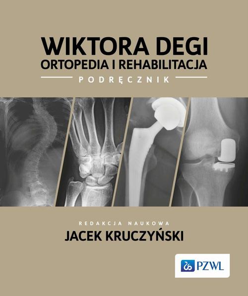 Tytuł: Wiktora Degi ortopedia i rehabilitacja
Autor: 
Wydawnictwo: PZWL
Formaty: EPUB, MOBI