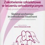 Tytuł: Zakotwienie szkieletowe w leczeniu ortodontycznym
Autor: Joanna Antoszewska-Smith, Moschos A. Papadopoulos, Nazan Küçükkeleş, Hanife Nuray Yılmaz
Wydawnictwo: Elamed
Formaty: PDF
