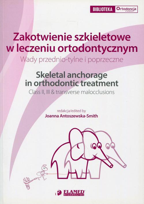 Tytuł: Zakotwienie szkieletowe w leczeniu ortodontycznym
Autor: Joanna Antoszewska-Smith, Moschos A. Papadopoulos, Nazan Küçükkeleş, Hanife Nuray Yılmaz
Wydawnictwo: Elamed
Formaty: PDF