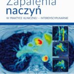 Zapalenia naczyń w praktyce klinicznej interdyscyplinarnie — okładka e-booka