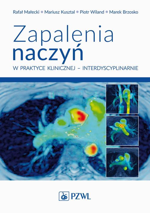 Tytuł: Zapalenia naczyń w praktyce klinicznej interdyscyplinarnie
Autor: Rafał Małecki, Mariusz Kusztal, Piotr Wiland, Marek Brzosko
Wydawnictwo: PZWL
Formaty: MOBI, EPUB