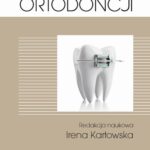 Tytuł: Zarys współczesnej ortodoncji
Autor: Irena Karłowska
Wydawnictwo: PZWL
Formaty: MOBI, EPUB