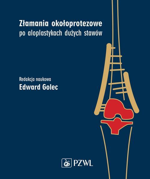 Tytuł: Złamania okołoprotezowe po aloplastykach dużych stawów
Autor: 
Wydawnictwo: PZWL
Formaty: MOBI, EPUB