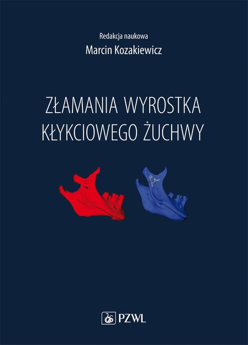 Tytuł: Złamania wyrostka kłykciowego żuchwy
Autor: Marcin Kozakiewicz
Wydawnictwo: PZWL
Formaty: EPUB, MOBI