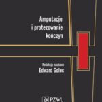 Tytuł: Amputacje i protezowanie kończyn
Autor: 
Wydawnictwo: PZWL
Formaty: MOBI, EPUB