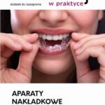 Aparaty nakładkowe w nowoczesnej ortodoncji — okładka e-booka