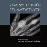 Tytuł: Atlas RTG zapalnych chorób reumatycznych
Autor: 
Wydawnictwo: PZWL
Formaty: EPUB, MOBI