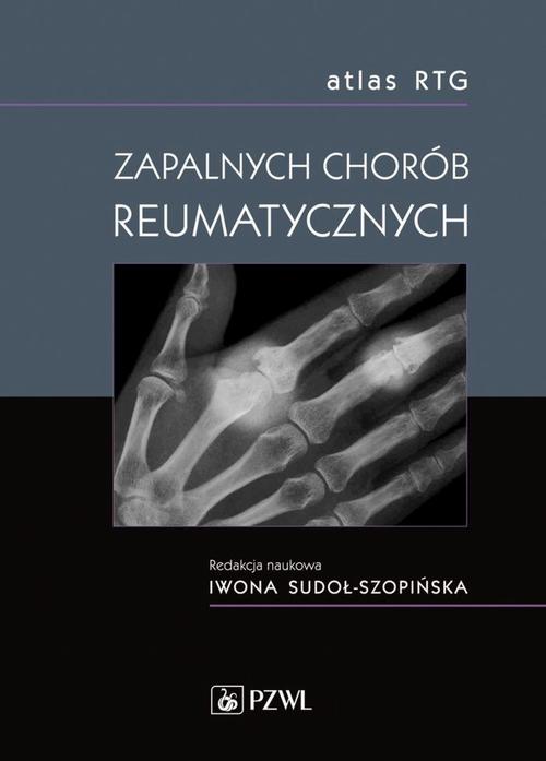 Tytuł: Atlas RTG zapalnych chorób reumatycznych
Autor: 
Wydawnictwo: PZWL
Formaty: EPUB, MOBI
