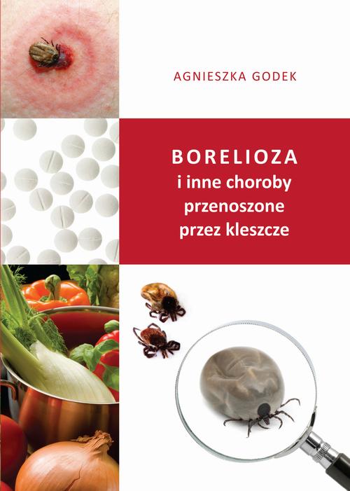 Tytuł: Borelioza i inne choroby przenoszone przez kleszcze
Autor: Agnieszka Godek
Wydawnictwo: Borgis
Formaty: EPUB