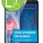 Tytuł: Choroba zwyrodnieniowa stawu kolanowego – co warto wiedzieć?
Autor: Katarzyna Sikorska-Siudek
Wydawnictwo: Medical Education
Formaty: PDF