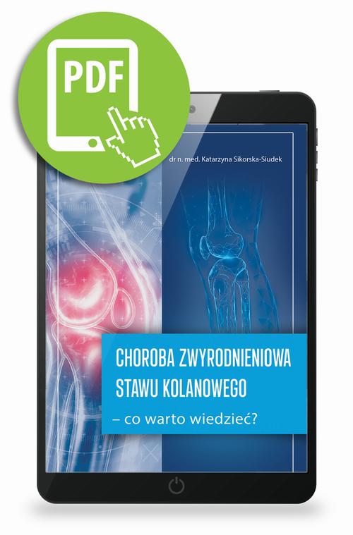 Tytuł: Choroba zwyrodnieniowa stawu kolanowego – co warto wiedzieć?
Autor: Katarzyna Sikorska-Siudek
Wydawnictwo: Medical Education
Formaty: PDF