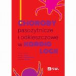 Tytuł: Choroby pasożytnicze i odkleszczowe w kardiologii
Autor: 
Wydawnictwo: PZWL
Formaty: MOBI, EPUB