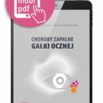 Tytuł: Choroby zapalne gałki ocznej - poradnik lekarza praktyka
Autor: Karolina Czajor, Marta Misiuk-Hojło
Wydawnictwo: Medical Education
Formaty: EPUB, PDF, MOBI
