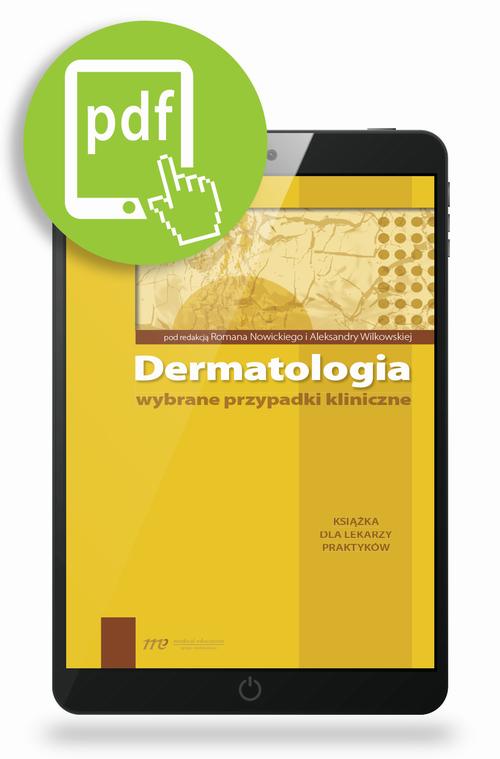 Tytuł: Dermatologia - wybrane przypadki kliniczne
Autor: Roman Nowicki, Aleksandra Wilkowska
Wydawnictwo: Medical Education
Formaty: PDF
