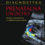 Diagnostyka prenatalna USG/ECHO. Zaburzenia czynnościowe w układzie krążenia płodu — okładka e-booka